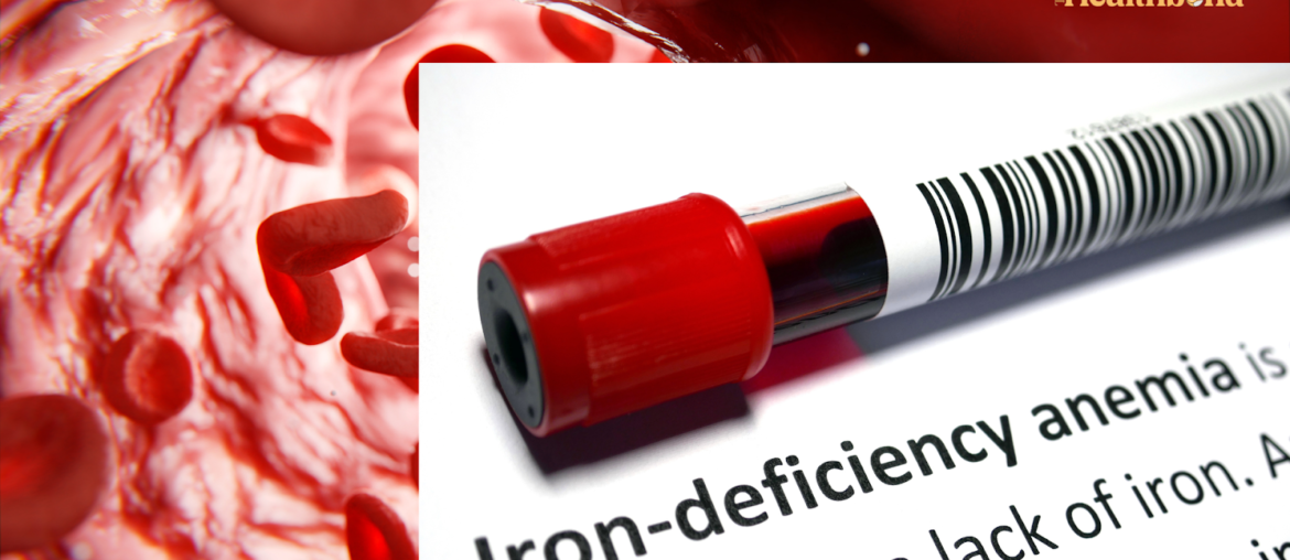 Iron-Deficiency Anemia, The Health Bond