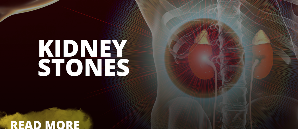 Kidney Stones, The Health Bond