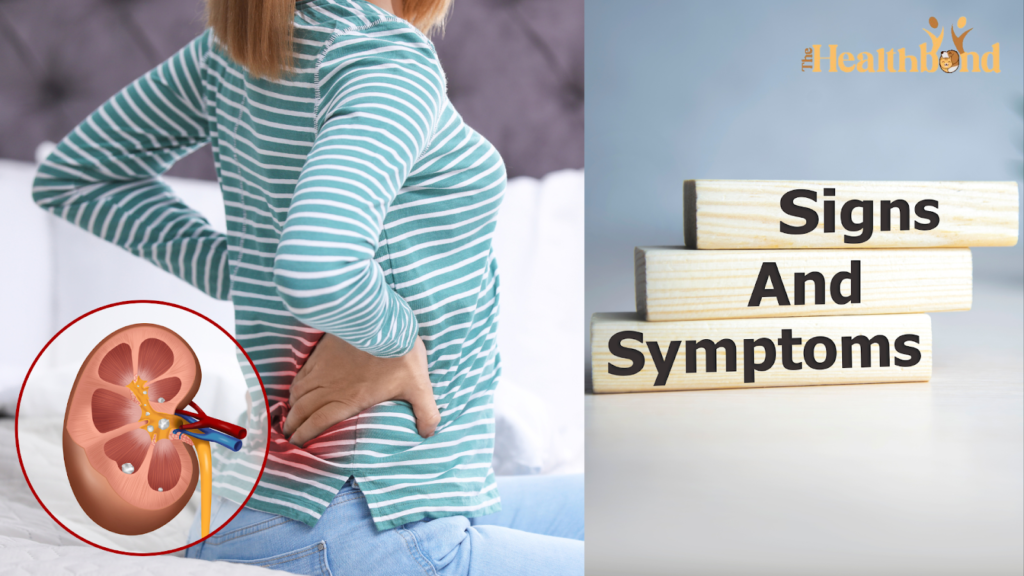 Signs and Symptoms of Kidney Stones, The Health Bond